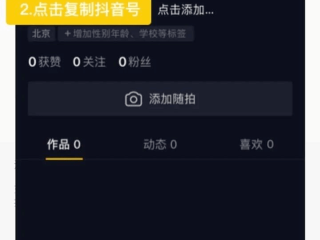 包含抖音充值入口的词条