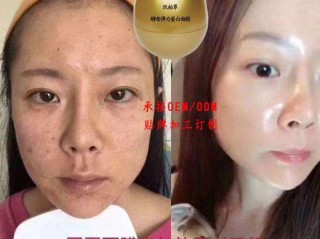 网红蛋蛋面膜功效真的好吗(新盟主网红蛋蛋面膜是真的吗)
