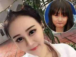 网红小冉抽脂医生,网红小冉抽脂填充哪里