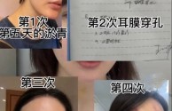 女主播虚构被家暴,直播卖惨求刷礼物,3个月捞金700多万,直播被女主播家暴怎么办